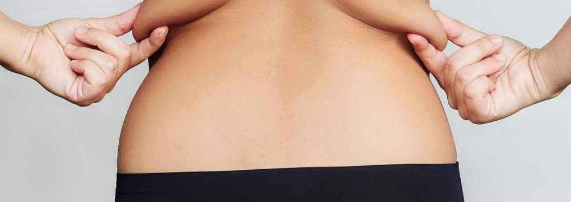 Ways to get rid of annoying back fat in women